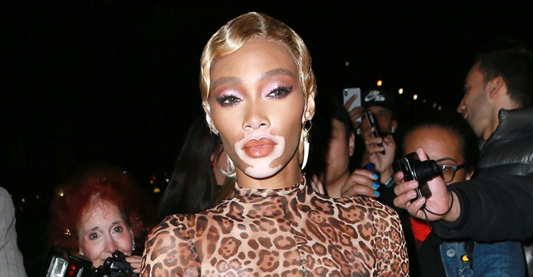 Winnie Harlow Winnie Harlow