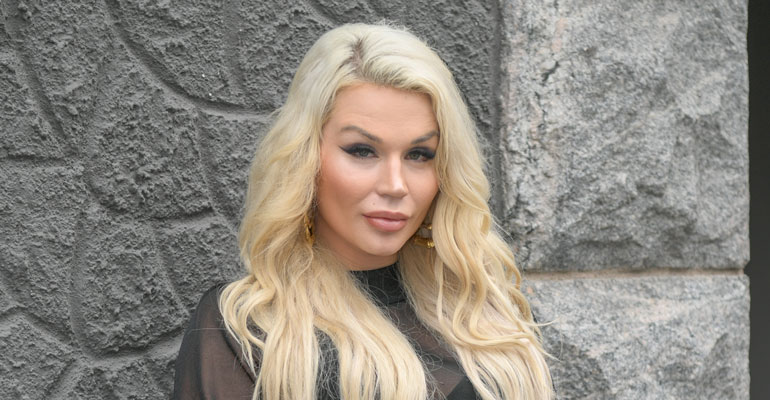 Sofia Hult turvautui kauneustoimenpiteeseen. Sofia Hult turvautui kauneustoimenpiteeseen.