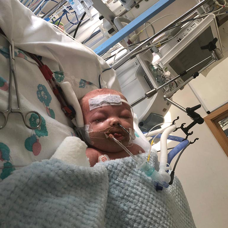 Oliveria pidettiin viikkoja koomassa sen jälkeen, kun hänet oli amputoitu.