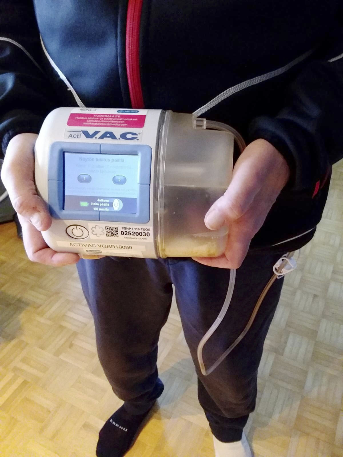 VAC