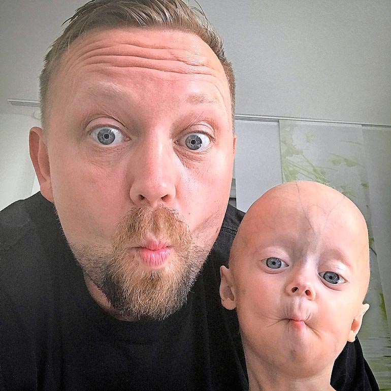 Luken isä Ronny lopetti työnsä viettääkseen mahdollisimman paljon aikaa poikansa kanssa.