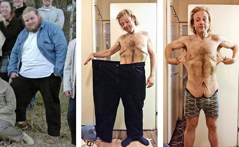 Tony painoi tuhdeimmillaan 204 kiloa vuonna 2008. Vuonna 2014 painoa oli pudonnut jo lähes 130 kiloa!