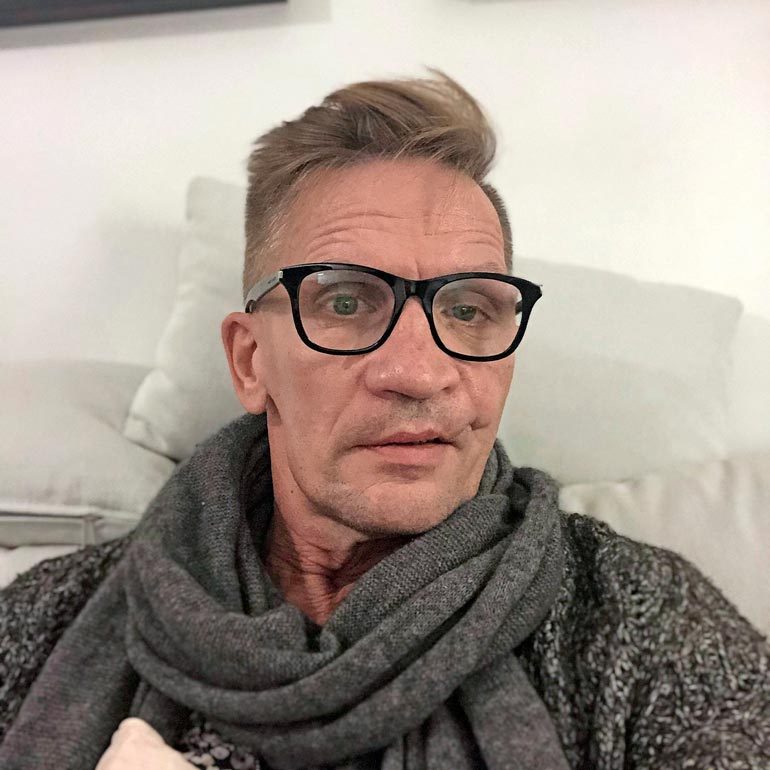 Sami Saikkonen joutui syyskuussa lento-onnettomuuteen, jossa yksi ihminen kuoli. – Itse olen jo kasvoihini tottunut, kaksi kertaa kasvoleikkauksen läpikäynyt lentäjä-näyttelijä kertoo.