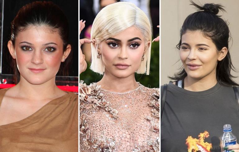 Kylie Jennerin muodonmuutos seitsemässä vuodessa
