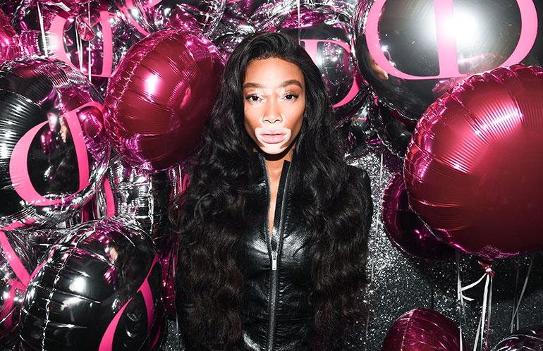 winnie harlow