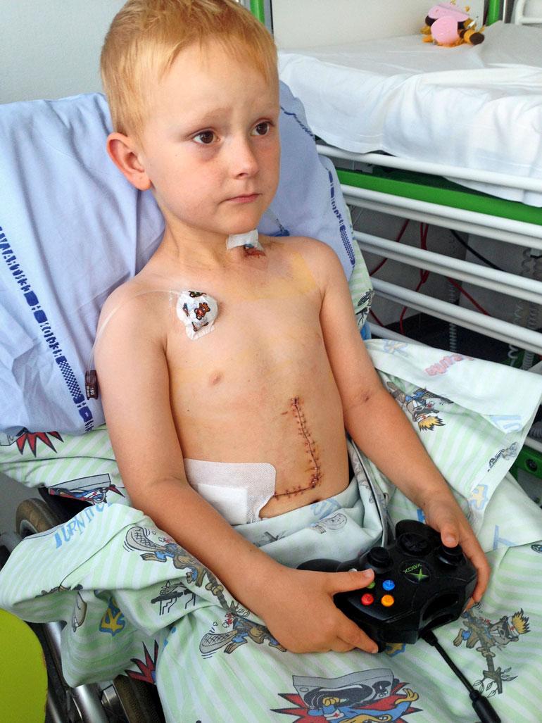 Noahille jää muistoksi suuri arpi vaikeasta sairaudesta.