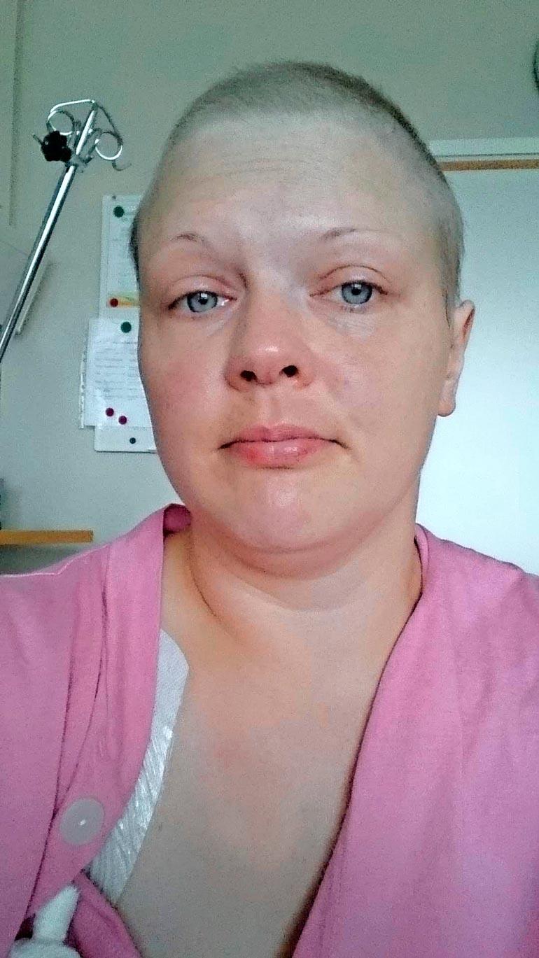 Syöpähoidot veivät hiukset ja koettelivat Sinin jaksamista.