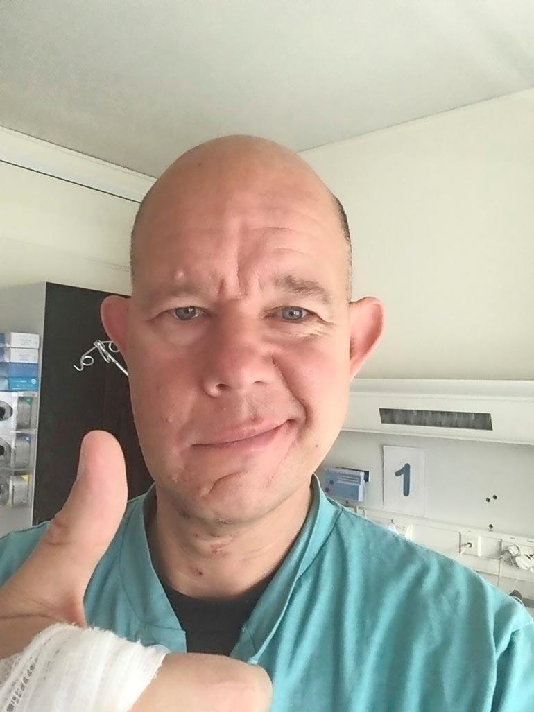 Kaitsu otti selfien sairaalassa, jossa häntä tutkittiin mystisen kasvohalvauksen takia.