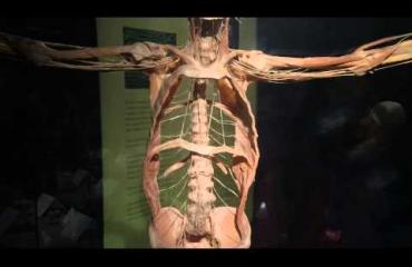 Miestä syytetään kuolleen varpaiden varastamisesta! Katso video!